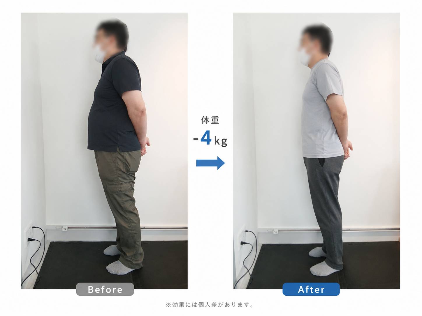 施術前後の変化を紹介する写真3枚目